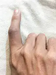 1000011642.webp