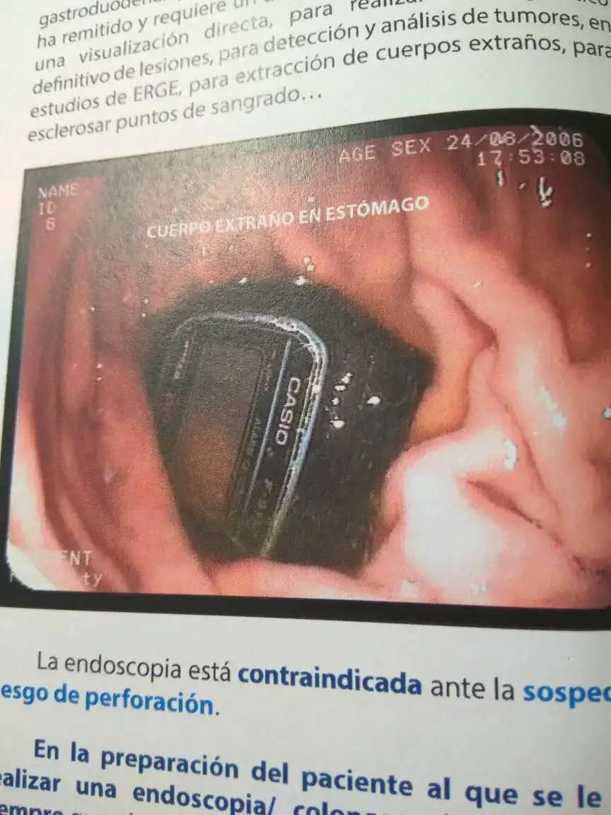 63a183f3208b2091ff9f7a1df593808f.webp