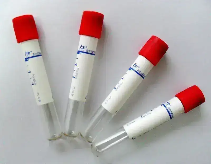 blood_sample_collection_tubes.webp
