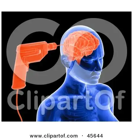 -Blue-Xray-Of-A-Drill-Drilling-Into-A-Womans-Brain.webp