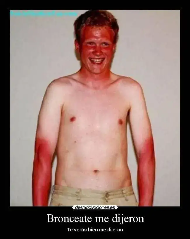 bronceado.webp