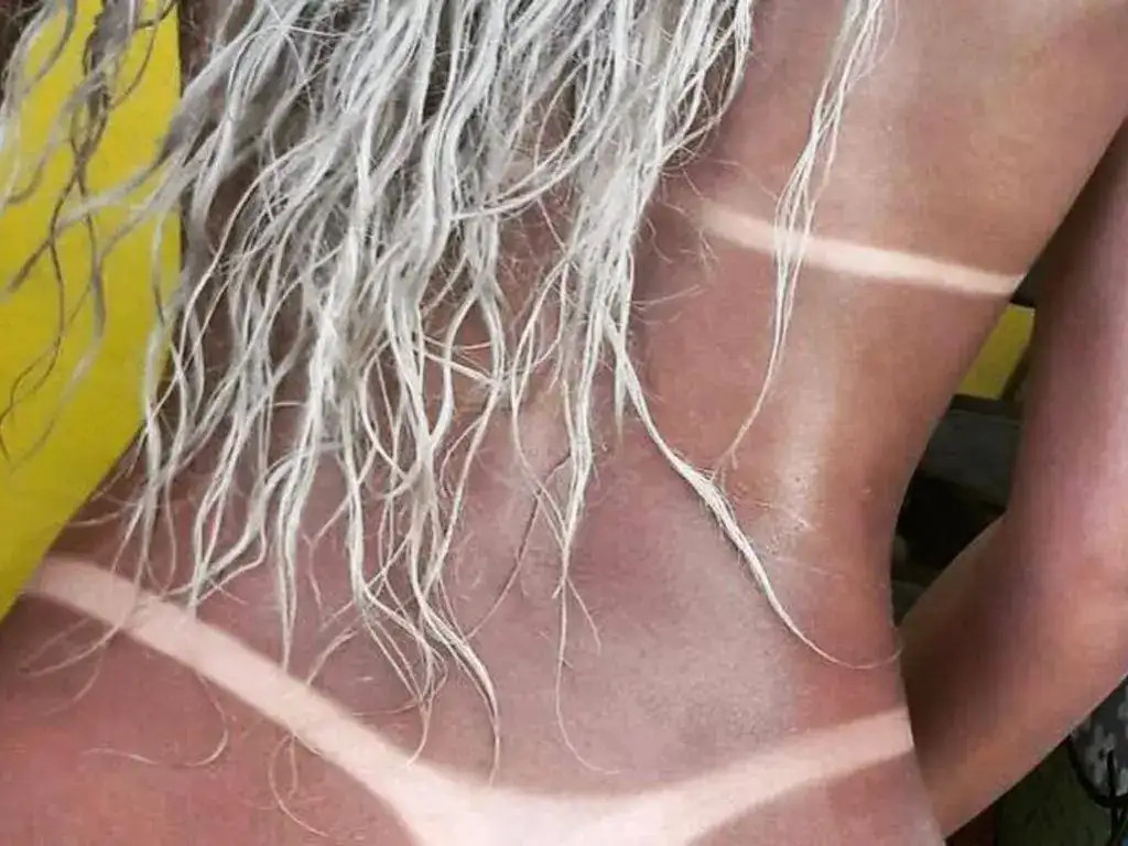 bronceado.webp