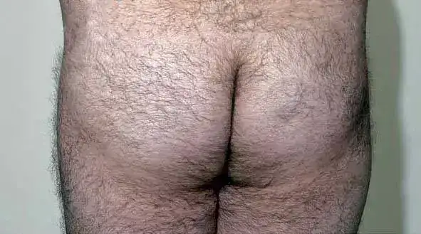 culo+peludo.webp