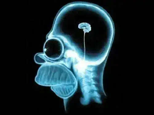 ensivo-de-internet-puede-causar-dao-cerebral_thumb.webp