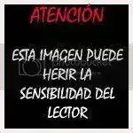 HERIRSENSIBILIDAD.webp
