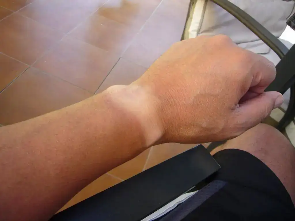 L1060315.webp
