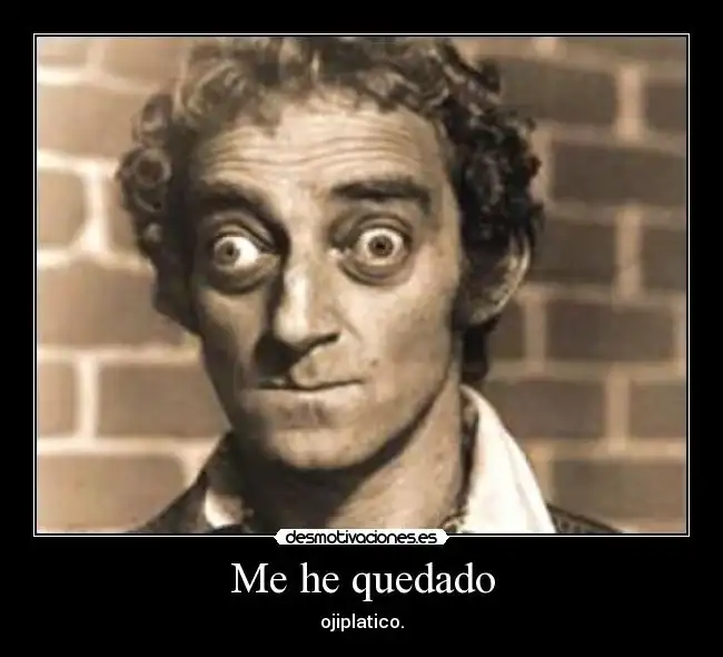 Marty_Feldman_ameri_186080m.webp