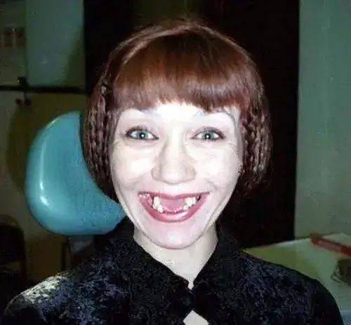 mujeres%2Bfeas%2B%25287%2529%255B3%255D.webp