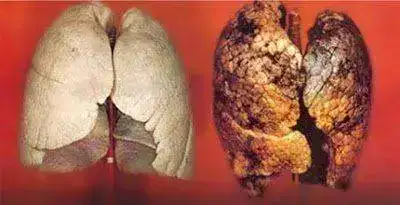 Pulmon-tabaco.webp