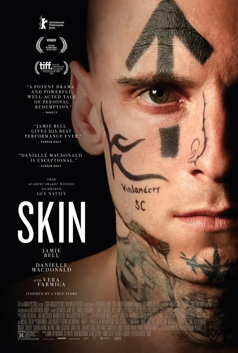 skin-988774585-large.webp