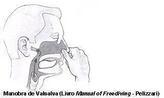 valsalva.webp