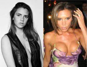 victoria_beckham_aumento_pecho.webp