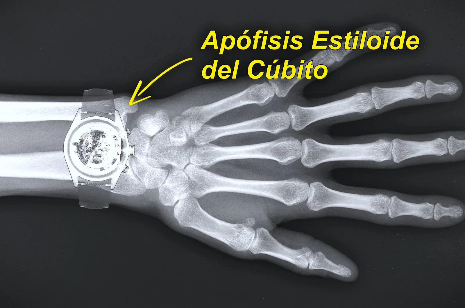 wrist watch position - copia.webp